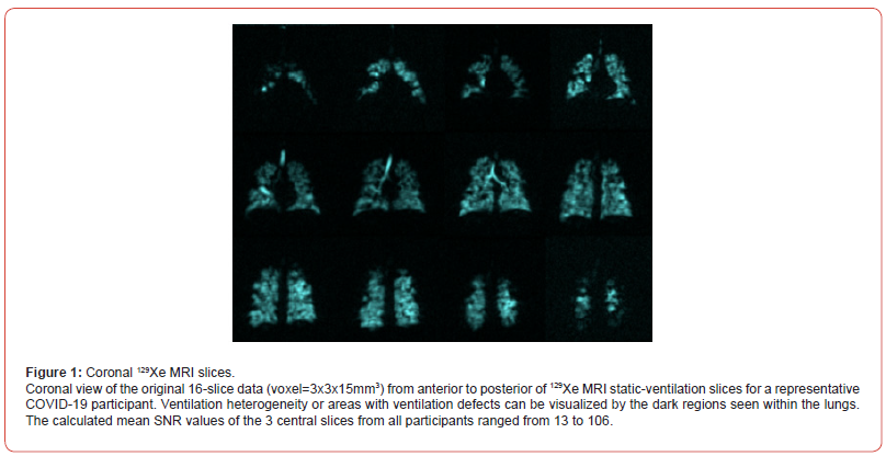 Click here to view Large Figure 1 irispublishers-openaccess-biomedical-engineering-biotechnology