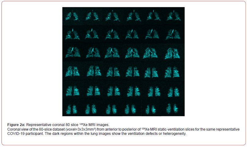 Click here to view Large Figure 2a irispublishers-openaccess-biomedical-engineering-biotechnology
