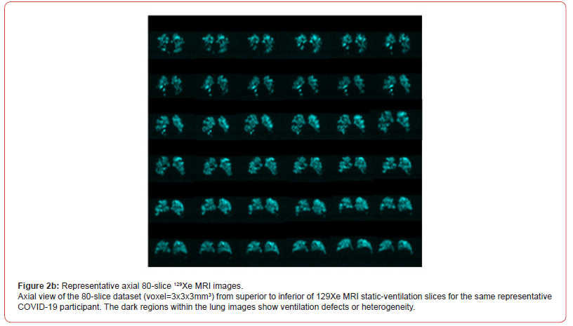 Click here to view Large Figure 2b irispublishers-openaccess-biomedical-engineering-biotechnology