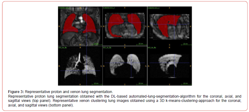 Click here to view Large Figure 3 irispublishers-openaccess-biomedical-engineering-biotechnology