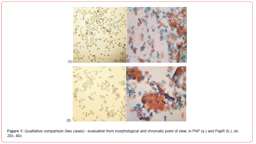 Click here to view Large Figure 1 irispublishers-openaccess-biomedical-engineering-biotechnology