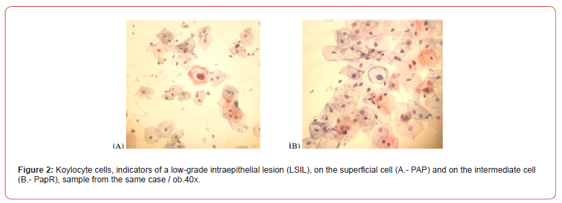 Click here to view Large Figure 2 irispublishers-openaccess-biomedical-engineering-biotechnology