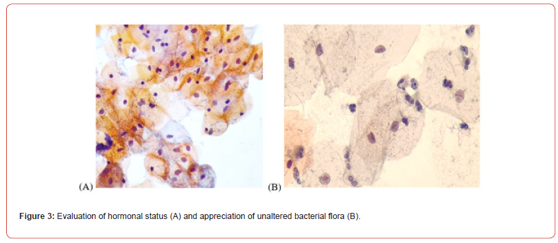 Click here to view Large Figure 3 irispublishers-openaccess-biomedical-engineering-biotechnology