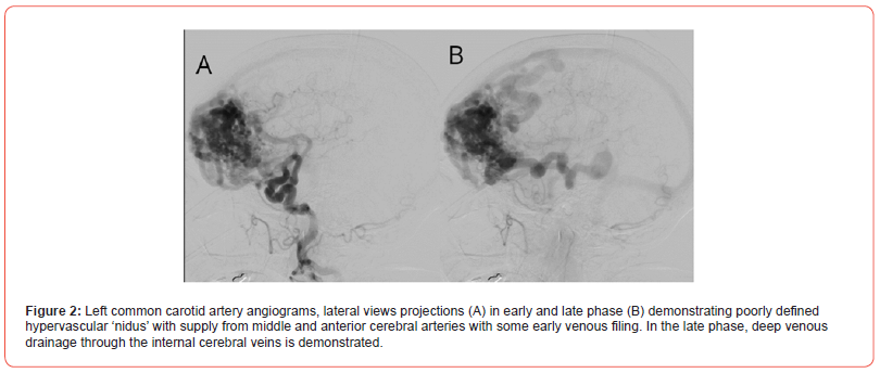 Click here to view Large Figure 2 irispublishers-openaccess-clinical-case-studies