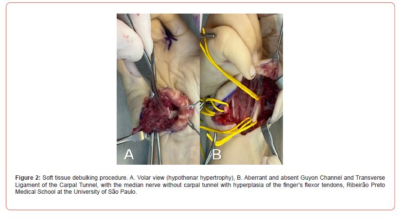 Click here to view Large Figure 2 irispublishers-openaccess-clinical-case-studies