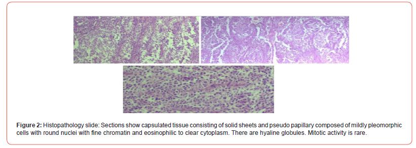 Click here to view Large Figure 2 irispublishers-openaccess-clinical-case-studies