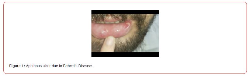 Click here to view Large Figure 1 irispublishers-openaccess-clinical-case-studies
