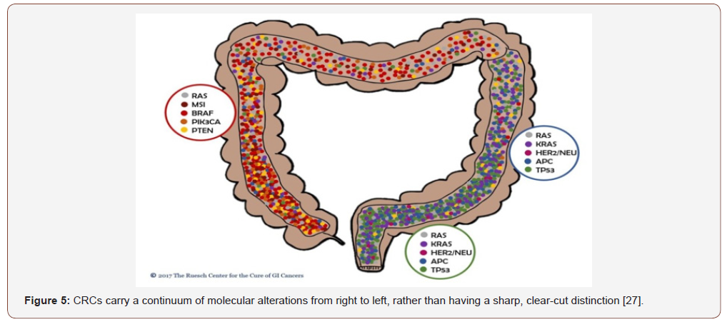 Comparison Of Risk Factors And Molecular Analysis Of Right Sided Colon 