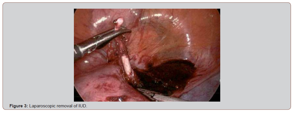 Click here to view Large Figure 3 irispublishers-openaccess-health-sciences-research