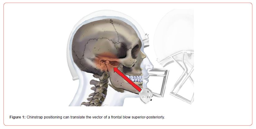 Click here to view Large Figure 1 irispublishers-openaccess-sports-science-medicine