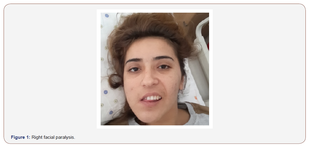 Click here to view Large Figure 1 irispublishers-openaccess-neurology-neuroscience