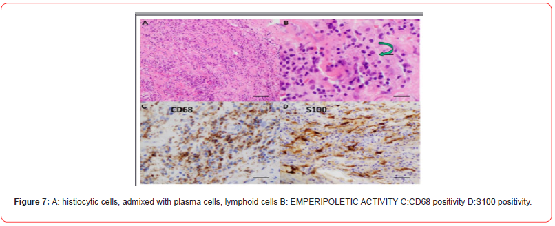 Click here to view Large Figure 7 irispublishers-openaccess-neurology-neuroscience