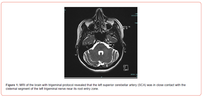Click here to view Large Figure 1 irispublishers-openaccess-neurology-neuroscience