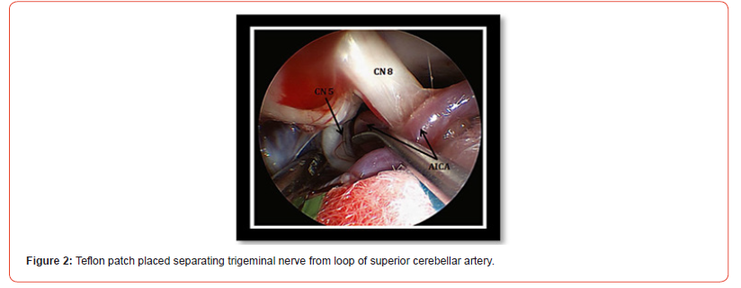 Click here to view Large Figure 2 irispublishers-openaccess-neurology-neuroscience