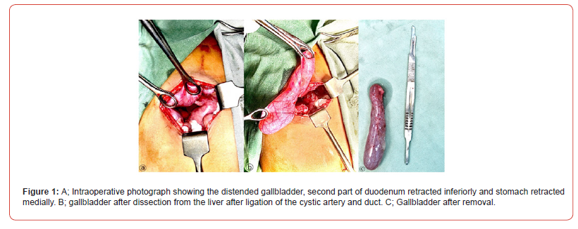 Click here to view Large Figure 1 irispublishers-openaccess-neurology-neuroscience