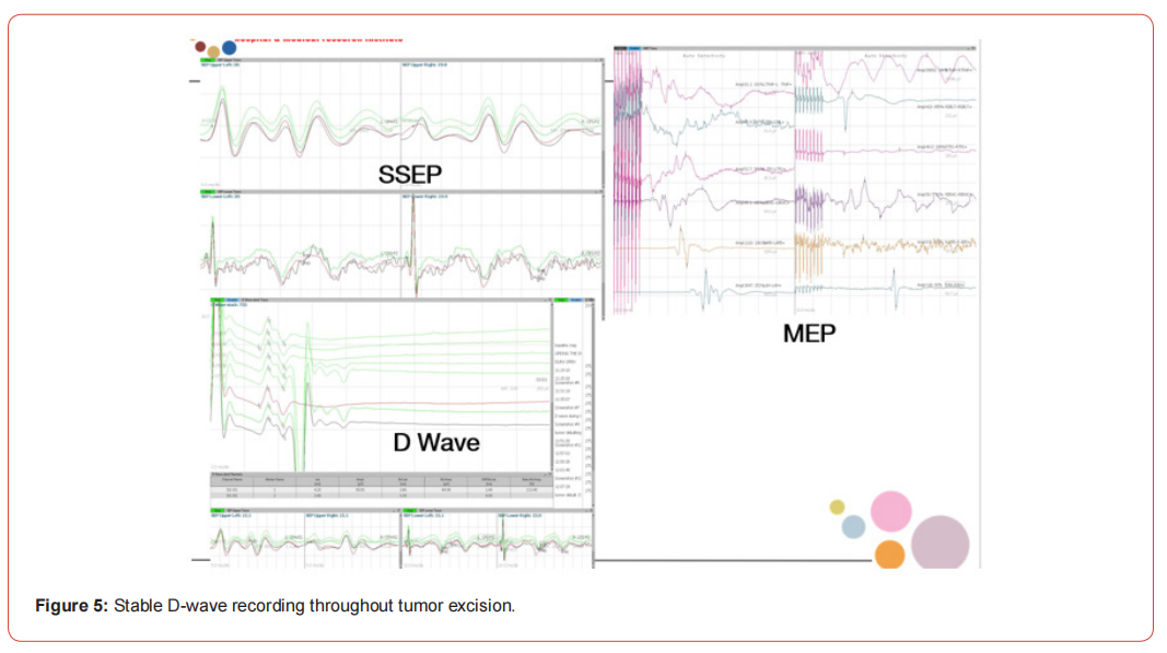 Click here to view Large Figure 1 irispublishers-openaccess-neurology-neuroscience