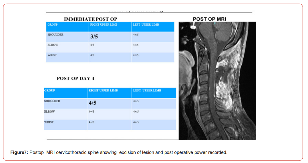 Click here to view Large Figure 1 irispublishers-openaccess-neurology-neuroscience