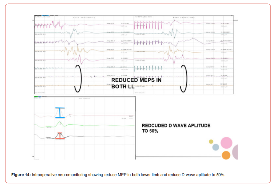 Click here to view Large Figure 1 irispublishers-openaccess-neurology-neuroscience