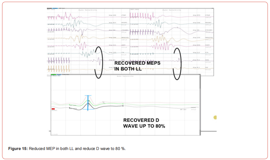 Click here to view Large Figure 1 irispublishers-openaccess-neurology-neuroscience