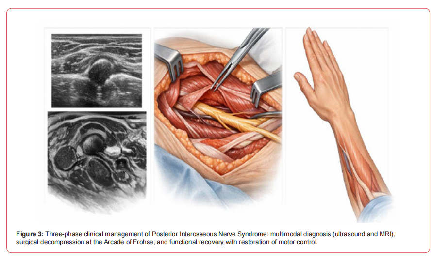 Click here to view Large Figure 1 irispublishers-openaccess-neurology-neuroscience