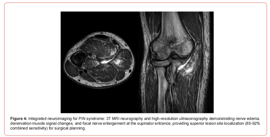 Click here to view Large Figure 1 irispublishers-openaccess-neurology-neuroscience