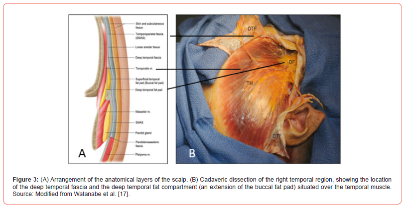 Click here to view Large Figure 3A irispublishers-openaccess-Anatomy-Physiology