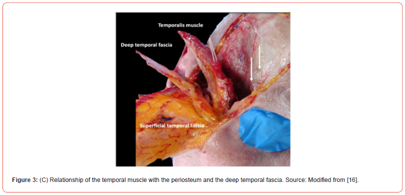 Click here to view Large Figure 3C irispublishers-openaccess-Anatomy-Physiology