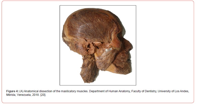 Click here to view Large Figure 4A irispublishers-openaccess-Anatomy-Physiology