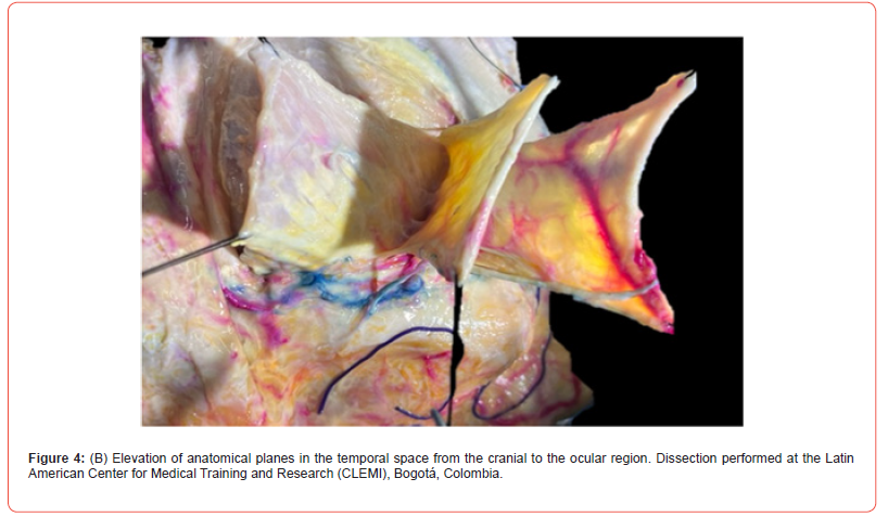 Click here to view Large Figure 4B irispublishers-openaccess-Anatomy-Physiology