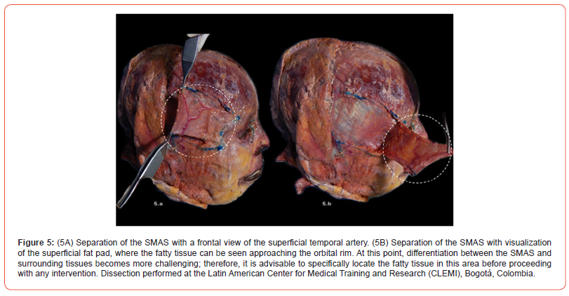 Click here to view Large Figure 5 irispublishers-openaccess-Anatomy-Physiology
