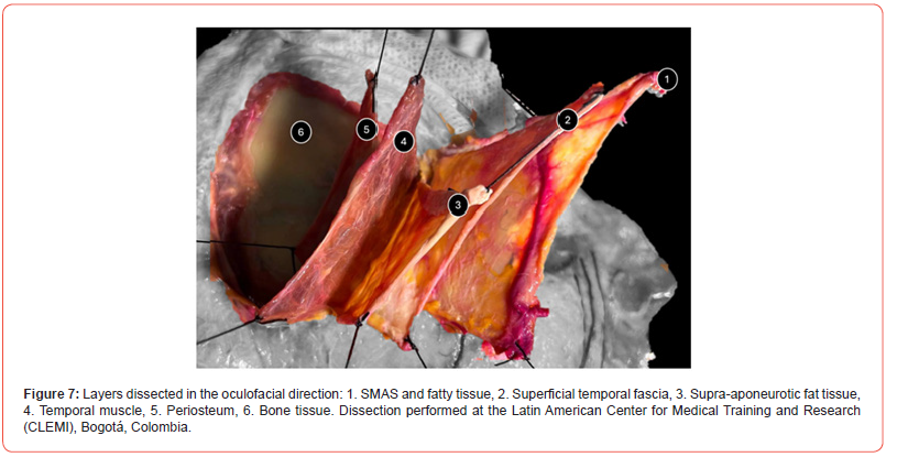 Click here to view Large Figure 7 irispublishers-openaccess-Anatomy-Physiology