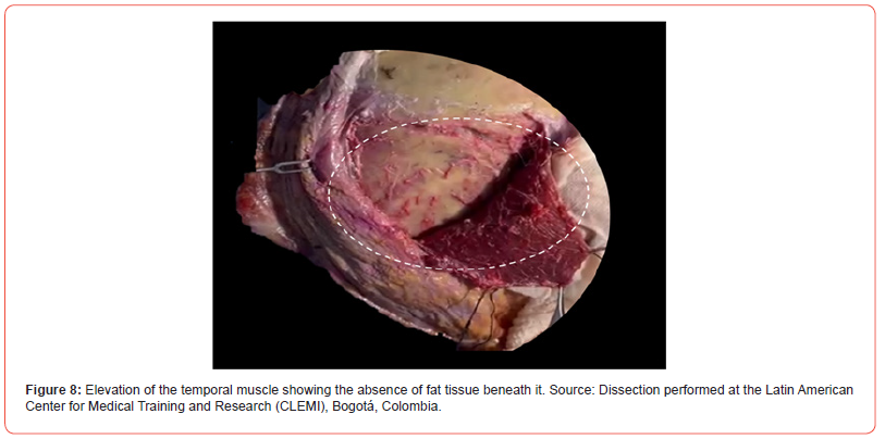 Click here to view Large Figure 8 irispublishers-openaccess-Anatomy-Physiology