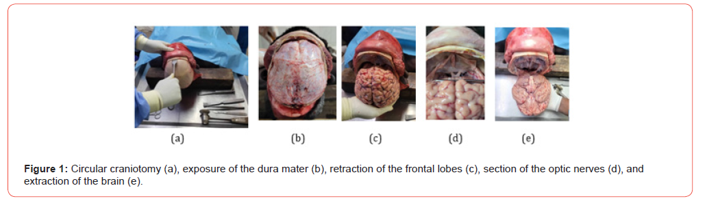 Click here to view Large Figure 1 irispublishers-openaccess-Anatomy-Physiology