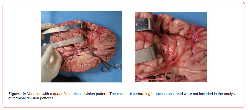 Click here to view Large Figure 10 irispublishers-openaccess-Anatomy-Physiology