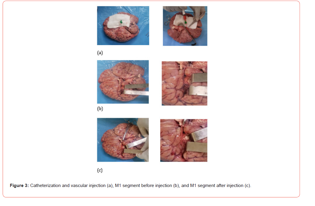 Click here to view Large Figure 3 irispublishers-openaccess-Anatomy-Physiology