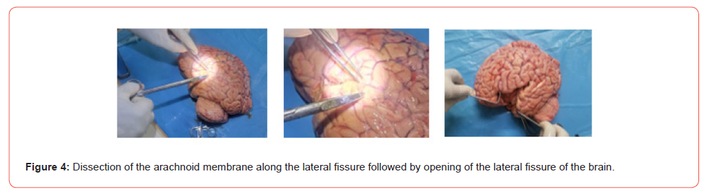 Click here to view Large Figure 4 irispublishers-openaccess-Anatomy-Physiology