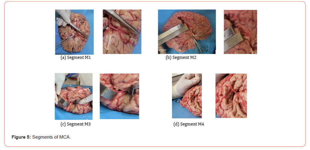 Click here to view Large Figure 5 irispublishers-openaccess-Anatomy-Physiology