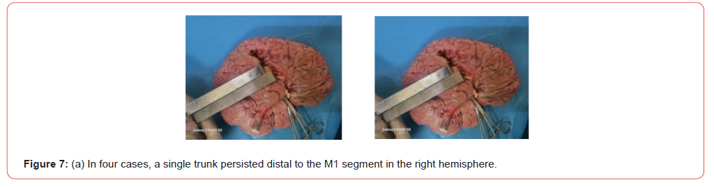 Click here to view Large Figure 7a irispublishers-openaccess-Anatomy-Physiology