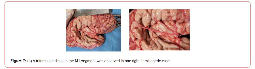 Click here to view Large Figure 7b irispublishers-openaccess-Anatomy-Physiology
