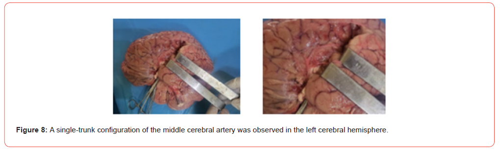 Click here to view Large Figure 8 irispublishers-openaccess-Anatomy-Physiology