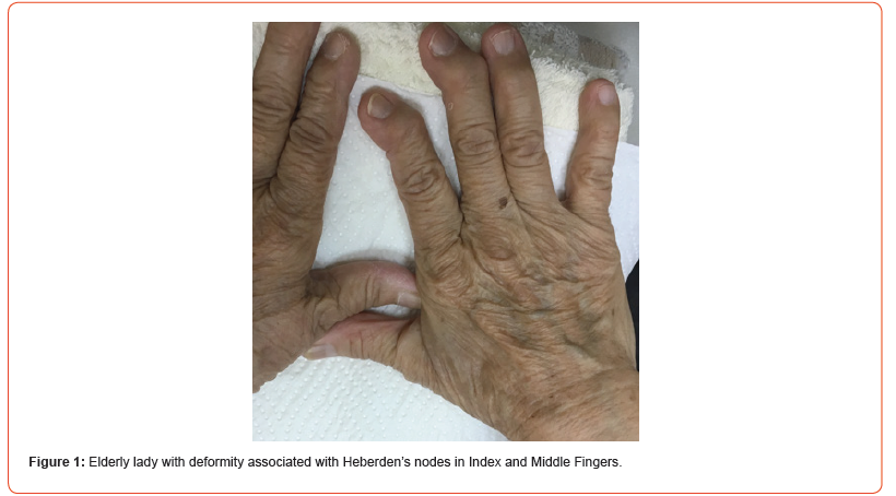 Click here to view Large Figure 1 irispublishers-openaccess-rheumatology-arthritis-research