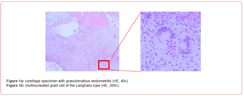 Click here to view Large Figure 1 irispublishers-openaccess-reproductive-medicine