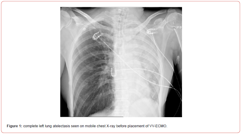 Click here to view Large Figure 1 irispublishers-openaccess-respiratory-pulmonary-medicine