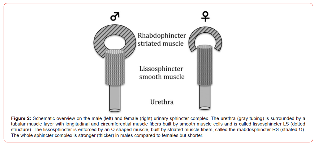 Click here to view Large Figure 2 irispublishers-openaccess-urology-nephrology