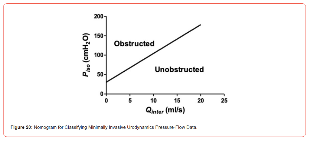 Click here to view Large Figure 20 irispublishers-openaccess-urology-nephrology
