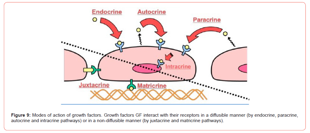 Click here to view Large Figure 9 irispublishers-openaccess-urology-nephrology