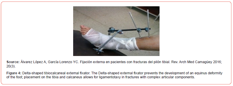 Click here to view Large Figure 4 irispublishers-openaccess-orthopedics-research