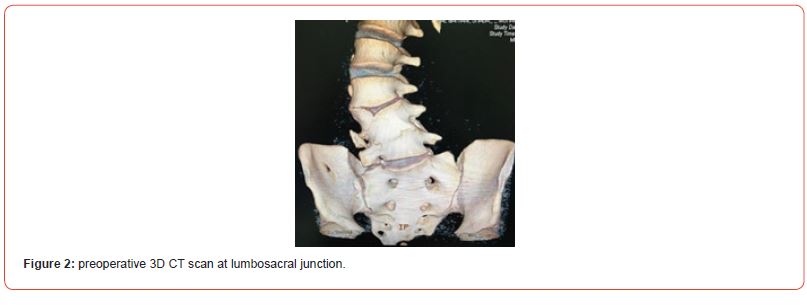 Click here to view Large Figure 2 irispublishers-openaccess-orthopedics-research