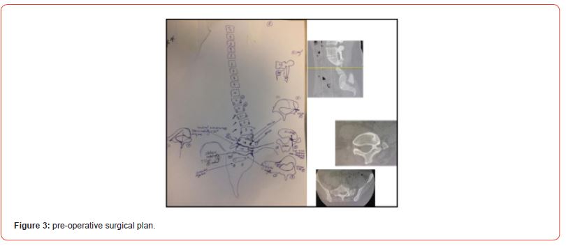 Click here to view Large Figure 3 irispublishers-openaccess-orthopedics-research