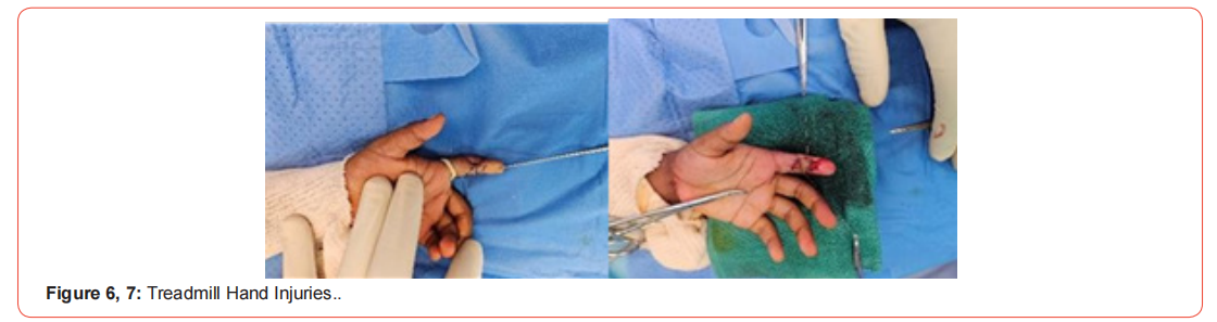 Click here to view Large Figure 2 irispublishers-openaccess-orthopedics-research